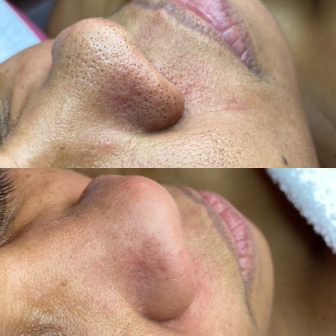 Lash Technician Service for EstheticX_by_Lamour